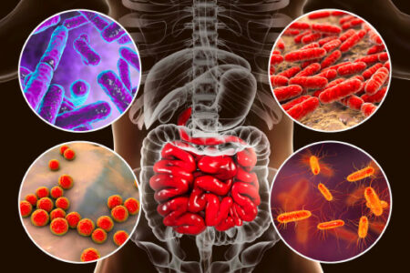 Microbiote