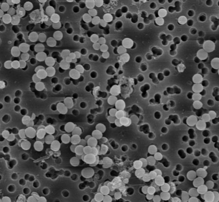 Impact of your antimicrobial solution on host response triggered by infection